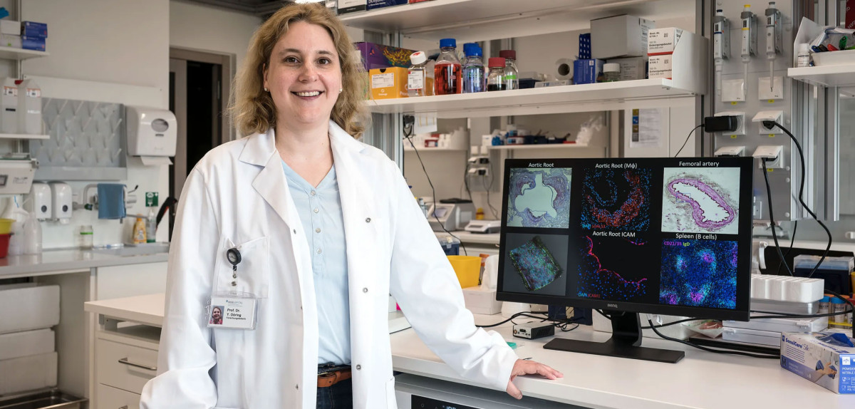 Forschungspreis 2024: Wie unsere Arterien Schaden nehmen