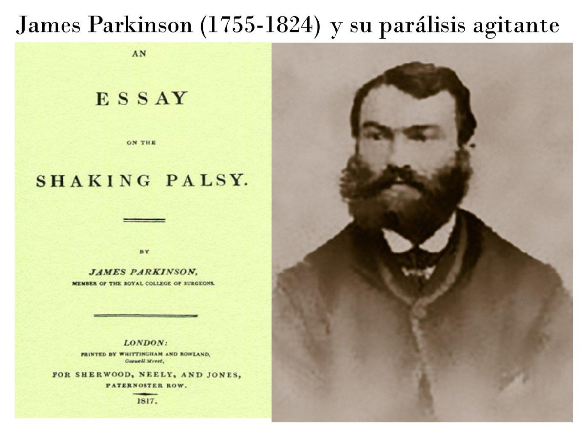 200. Todestag von James Parkinson – Ein Pionier der Medizin im Fokus